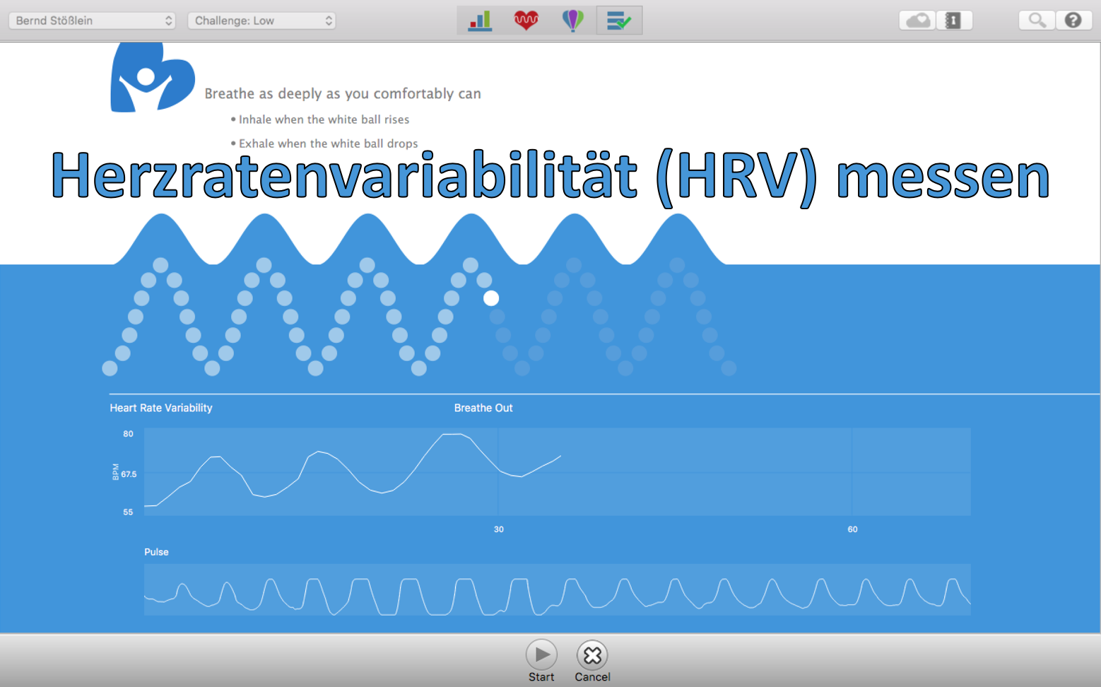 Herzratenvariabilität messen